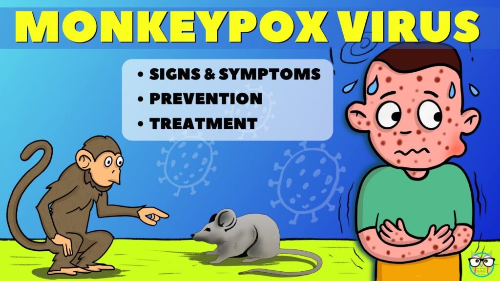 Monkeypox Virus-upsc-vishnu ias